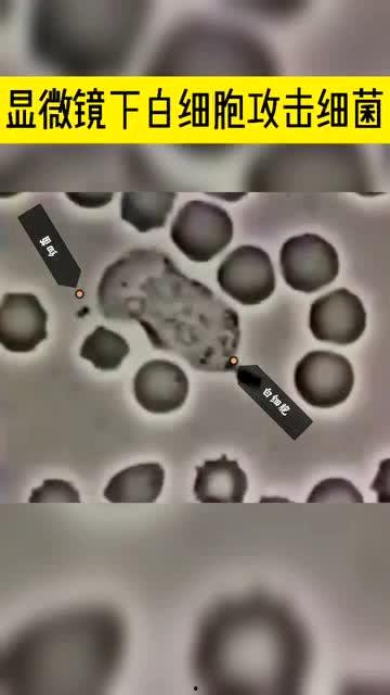 白细胞吞噬细菌视频,微观战场上的英勇瞬间
